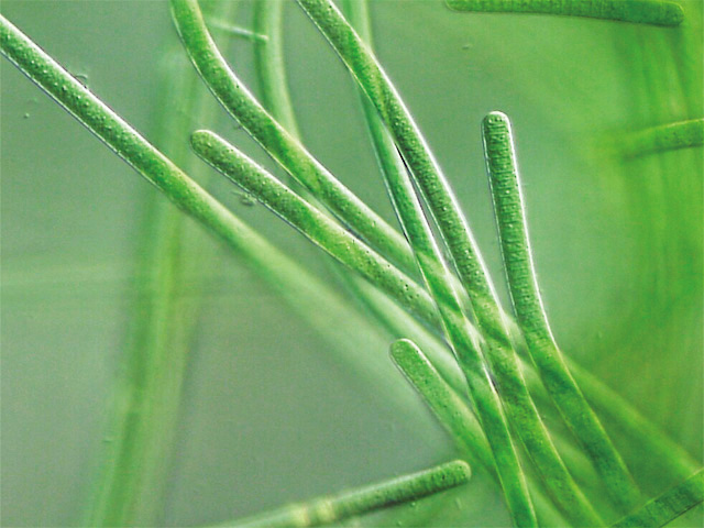 シアノバクテリアの写真