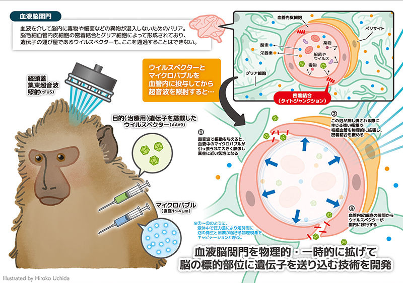 文章を入れてください