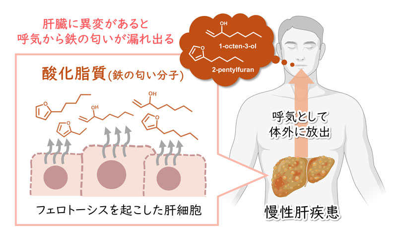 文章を入れてください