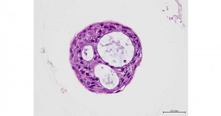 気管支オルガノイドを用いた新型コロナウイルス研究とその創薬応用