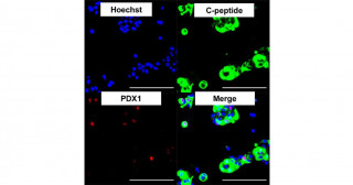 New Method for Cell Sorting Utilizing microRNA Switch and Magnetic Microbeads