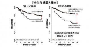 移植の成功に重要なのは、「質の良い」筋肉―コンピュータ断層撮影を用いて評価した骨格筋指標での検討―