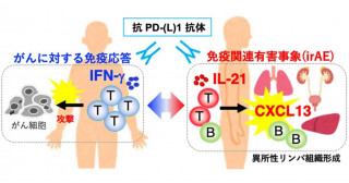 がん免疫療法の副反応による臓器傷害の原因解明に新たな一歩―がんに対する免疫応答と、有害事象に関わる免疫応答の違い―