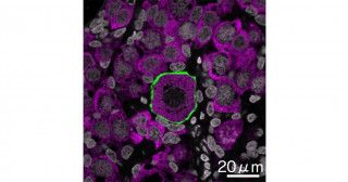 ヒト・サルの胎児卵巣から原始卵胞を体外で作出することに成功