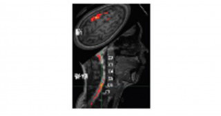 新規MRI技術で利き手の神経制御メカニズムを解明～手指運動中の脳・脊髄機能結合パターンの左右差を世界で初めて計測～