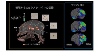 パーキンソン病の認知機能障害は鼻からはじまる？―レヴィ小体病における嗅覚系伝播経路の解明―