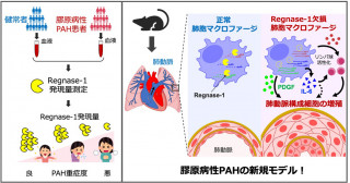難病「肺動脈性肺高血圧症」の病態を解明―肺胞マクロファージのRegnase-1による制御機構―