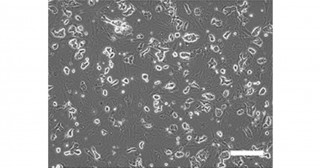 優れた多分化能を持つヒトのナイーブ型iPS細胞を迅速に作製する方法を発明