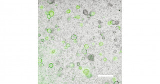 Successful generation of human iPS cell-derived mesenchymal cells capable of producing alveolar organoids