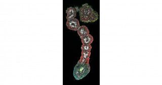 Sculpting the Human Body Plan in a Dish