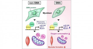 脊髄性筋萎縮症における骨格筋病変の発症メカニズムの一部を解明