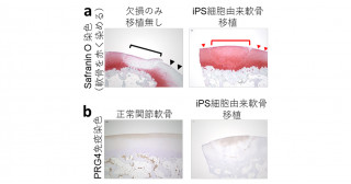 同種iPS細胞から作った軟骨により関節を再生―移植物が関節軟骨を構築する新技術―