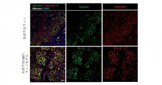 デュシェンヌ型筋ジストロフィー（DMD）に対する細胞治療研究の非臨床試験に向けた免疫不全DMDモデルラットの確立