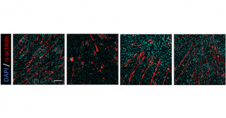 A simple model to evaluate skeletal muscle-macrophage interaction during skeletal muscle regeneration