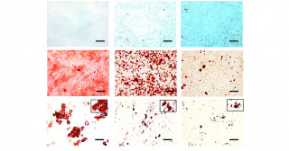 Generation of high-quality cartilage from iPS cell-derived mesenchymal stem cells