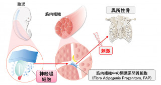 進行性骨化性線維異形成症の異所性骨は神経堤細胞から作られる