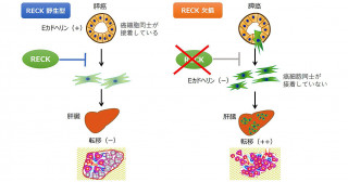 膵癌悪性化の分子機構解明—RECK発現の低下が膵癌の浸潤・転移を引き起こす—