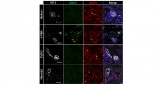 ヒトiPS細胞から作製した腎オルガノイドを用いたアルポート症候群病態モデルの開発