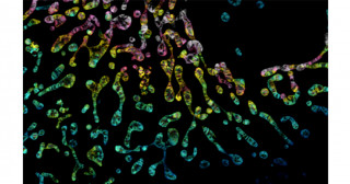 蛍光タンパク質StayGoldの性能アップ－分子や膜の動態を時空間的に高解像で観察する技術－