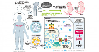 家族性骨形成不全症に伴う低身長の病態メカニズムを解明―TRIC-Bチャネル欠損による軟骨細胞の機能不全と細胞死―