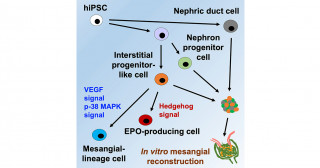 Learning from renal development to generate better kidney organoids for regenerative medicine
