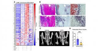 Inhibition of oxidative phosphorylation points to a new potential treatment fo