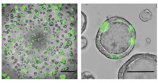 Constructing "on-gel" alveolar organoids as a new screening platform