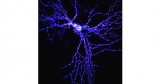 神経シナプス後部のタンパク質の集積を司る因子を発見