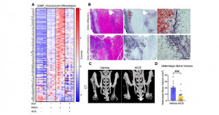 酸化的リン酸化の抑制がFOPの新たな治療法に繋がる可能性