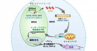 ウェルナー症候群に多い動脈硬化の発症メカニズムが明らかに ～創薬開発への手がかりとなる動脈硬化研究の新たなプラットフォーム～