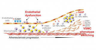 Unraveling the Mystery of Atherosclerosis in Patients with Werner Syndrome