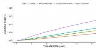 心電図によるスクリーニングと心血管疾患発症の詳細な関連が明らかに