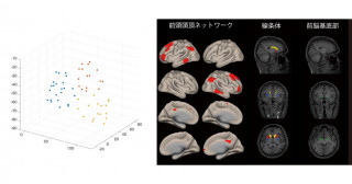パーキンソン病患者の歩行障害に関与する脳内ネットワーク