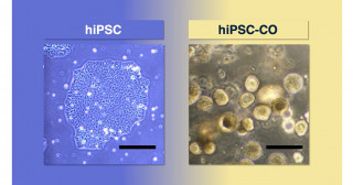 Creating a more accurate model of inflammatory bowel disease