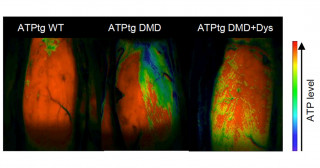 Preventing skeletal muscle fatigue in Duchenne muscular dystrophy by cell therapy