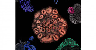 Seeing is believing: Leveraging defining morphological features for accurate selection of brain organoids