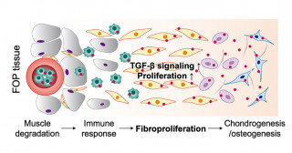Preventing painful BMP-9-mediated flare-ups in fibrodysplasia ossificans progressiva